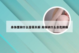 身体里缺什么容易长癣 身体缺什么会出脚癣