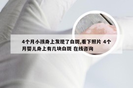 4个月小孩身上发现了白斑,看下照片 4个月婴儿身上有几块白斑 在线咨询