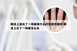 眼皮上面长了一块癣用什么药管用效果好 眼皮上长了一块癣怎么办