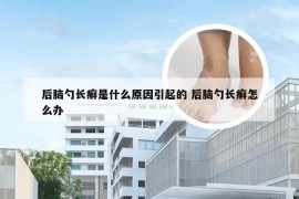 后脑勺长癣是什么原因引起的 后脑勺长癣怎么办