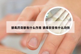 狼毒药膏都有什么作用 狼毒软膏有什么功效