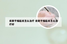 皮肤干燥起皮怎么治疗 皮肤干燥起皮怎么治疗好