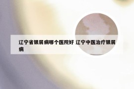 辽宁省银屑病哪个医院好 辽宁中医治疗银屑病