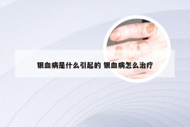 银血病是什么引起的 银血病怎么治疗