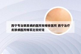 西宁专治银屑病的医院有哪些医院 西宁治疗皮肤病医院哪家比较好走