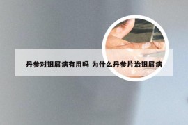 丹参对银屑病有用吗 为什么丹参片治银屑病