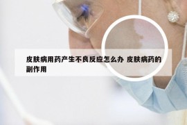 皮肤病用药产生不良反应怎么办 皮肤病药的副作用