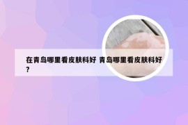 在青岛哪里看皮肤科好 青岛哪里看皮肤科好?