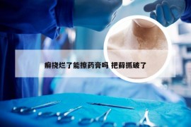 癣挠烂了能擦药膏吗 把藓抓破了