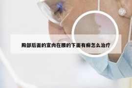 殿部后面的宣肉在腰的下面有癣怎么治疗