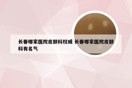 长春哪家医院皮肤科权威 长春哪家医院皮肤科有名气