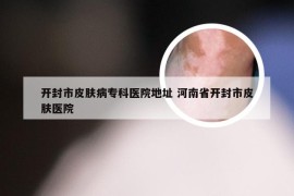 开封市皮肤病专科医院地址 河南省开封市皮肤医院