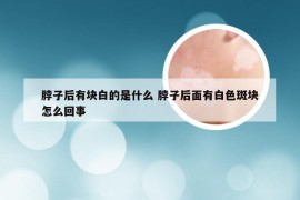 脖子后有块白的是什么 脖子后面有白色斑块怎么回事