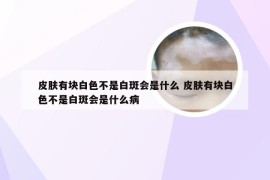 皮肤有块白色不是白斑会是什么 皮肤有块白色不是白斑会是什么病