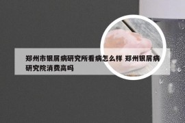 郑州市银屑病研究所看病怎么样 郑州银屑病研究院消费高吗
