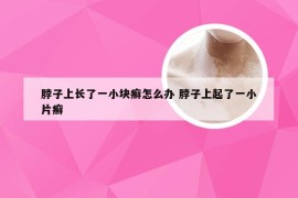 脖子上长了一小块癣怎么办 脖子上起了一小片癣