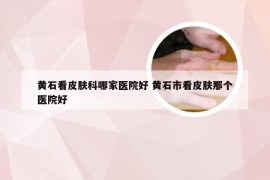 黄石看皮肤科哪家医院好 黄石市看皮肤那个医院好