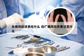 白癜风应该多吃什么 白疒癜风饮食要注意什么