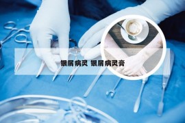 银屑病灵 银屑病灵膏