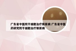 广东省中医院干细胞治疗银屑病 广东省中医药研究院干细胞治疗银屑病