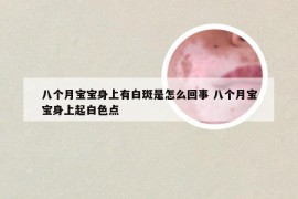 八个月宝宝身上有白斑是怎么回事 八个月宝宝身上起白色点