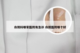 白斑科哪家医院有急诊 白斑医院哪个好