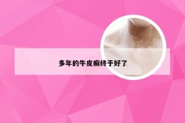 多年的牛皮癣终于好了