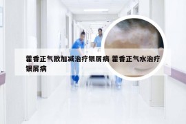 藿香正气散加减治疗银屑病 藿香正气水治疗银屑病
