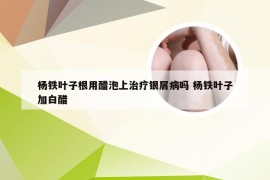 杨铁叶子根用醋泡上治疗银屑病吗 杨铁叶子加白醋