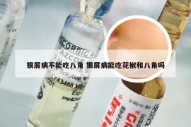 银屑病不能吃八角 银屑病能吃花椒和八角吗