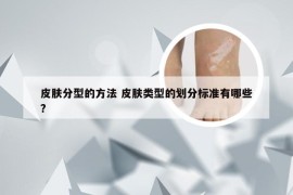 皮肤分型的方法 皮肤类型的划分标准有哪些?