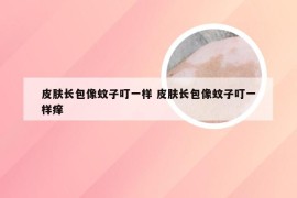 皮肤长包像蚊子叮一样 皮肤长包像蚊子叮一样痒