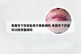 毒霸天下软膏能用于银屑病吗 毒霸天下药膏可以擦阴囊痒吗