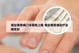 烟台银屑病门诊报销上限 烟台银屑病治疗去哪家好