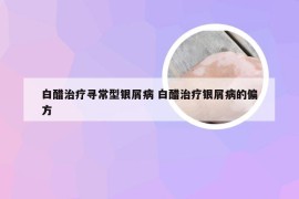 白醋治疗寻常型银屑病 白醋治疗银屑病的偏方