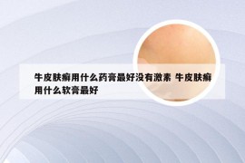 牛皮肤癣用什么药膏最好没有激素 牛皮肤癣用什么软膏最好