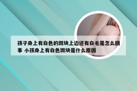 孩子身上有白色的斑块上边还有白毛是怎么回事 小孩身上有白色斑块是什么原因