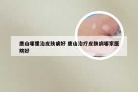 唐山哪里治皮肤病好 唐山治疗皮肤病哪家医院好