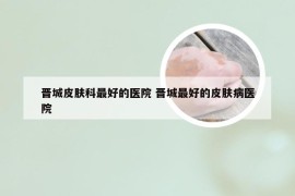 晋城皮肤科最好的医院 晋城最好的皮肤病医院