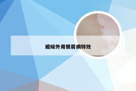 蟾蜍外用银屑病特效