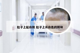 肚子上起白斑 肚子上长白色的斑块