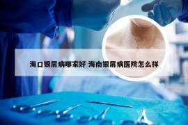 海口银屑病哪家好 海南银屑病医院怎么样