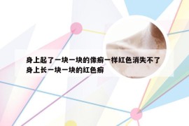 身上起了一块一块的像癣一样红色消失不了 身上长一块一块的红色癣