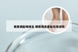 银屑病能喝绿豆 银屑病患者能吃绿豆吗