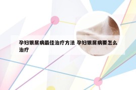 孕妇银屑病最佳治疗方法 孕妇银屑病要怎么治疗