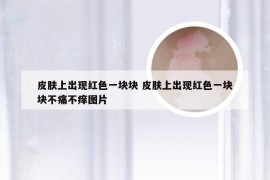 皮肤上出现红色一块块 皮肤上出现红色一块块不痛不痒图片