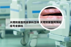 大理附属医院皮肤科怎样 大理附属医院预约挂号皮肤科
