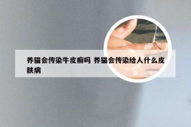养猫会传染牛皮癣吗 养猫会传染给人什么皮肤病