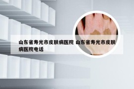 山东省寿光市皮肤病医院 山东省寿光市皮肤病医院电话