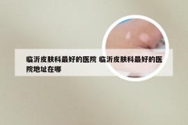 临沂皮肤科最好的医院 临沂皮肤科最好的医院地址在哪